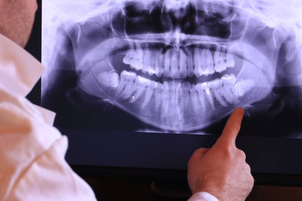 Best Emergency Tooth Extraction in Magnolia, TX