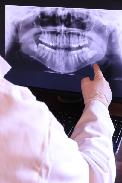 Best Emergency Wisdom Teeth Removal in Magnolia, TX